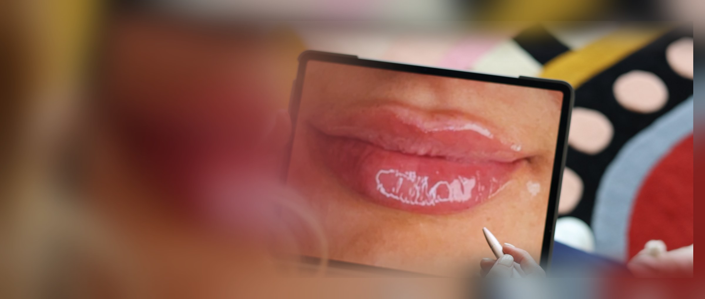 A provider reviewing a lip treatment plan on a tablet at Gudgel Aesthetics